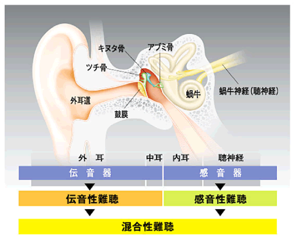 難聴には大きく分けて3種類あります。